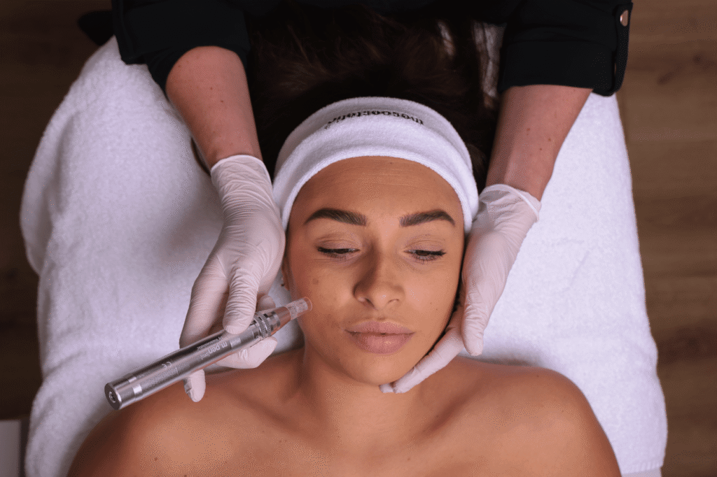 Facelift laserspecialist santpoort